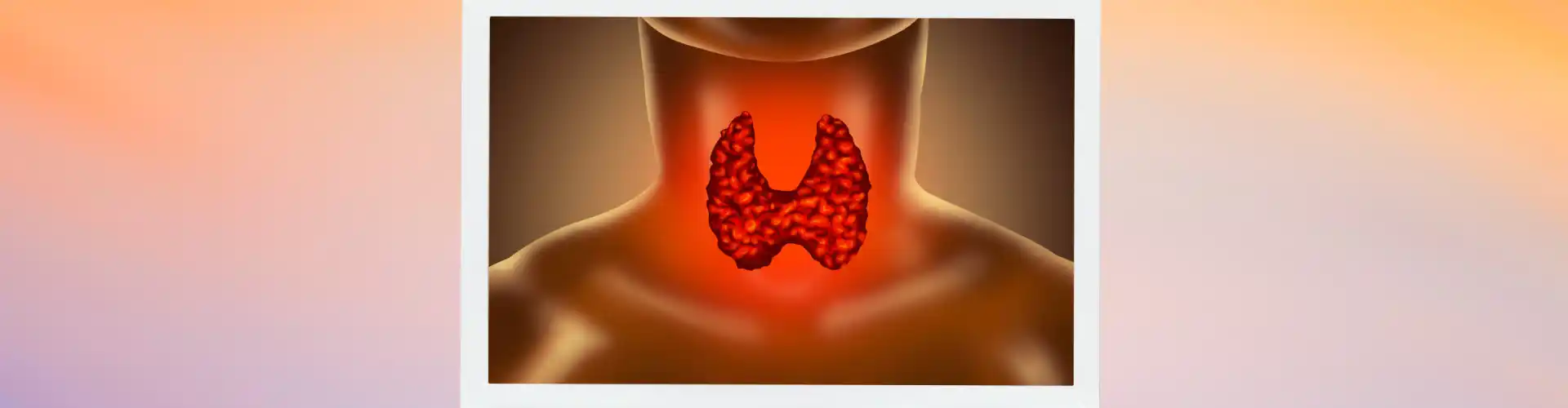 Hypothyroidism Type II - Managing how your cells use oxygen to make energy - Online Class by Bruce Dickson